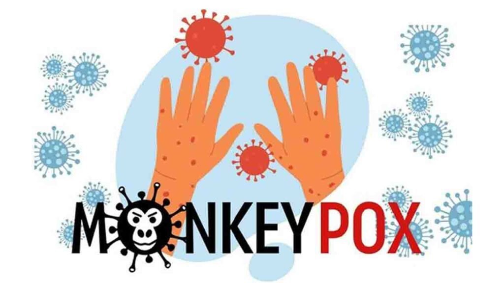 Monkeypox In India